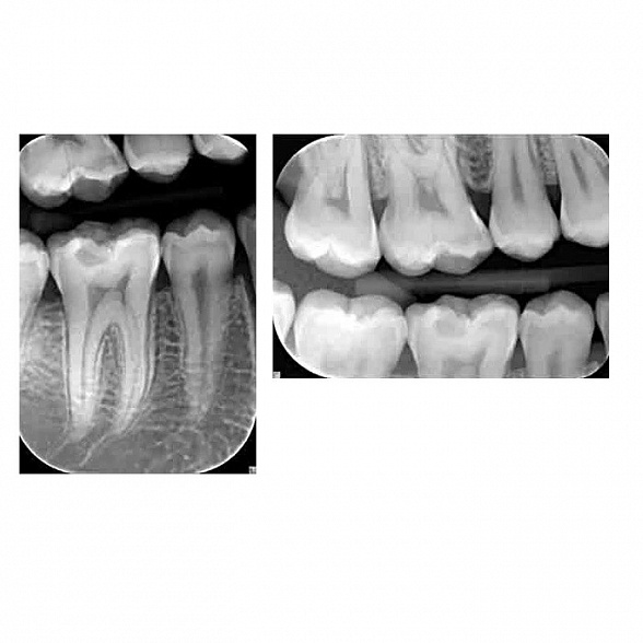 KaVo FOCUS - настенный дентальный рентгеновский аппарат | KaVo (Германия)