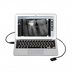 Радиовизиограф Mercury Digisens