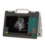 УЗИ сканер SmartScan 15