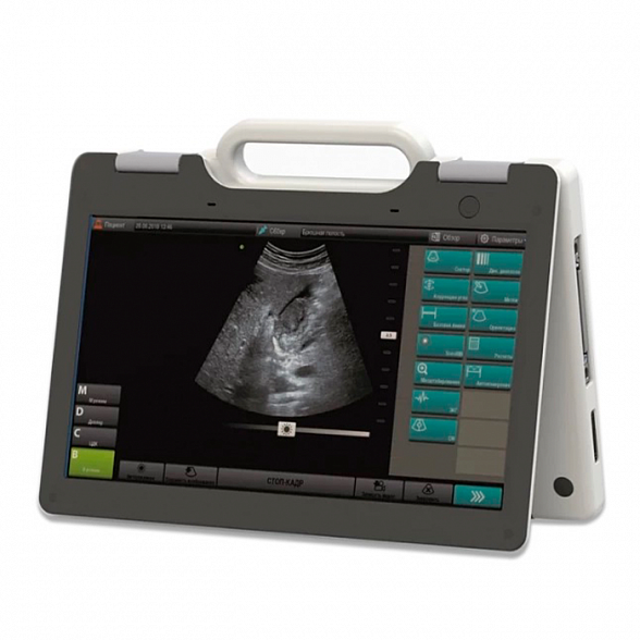 УЗИ сканер SmartScan 15