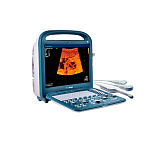 Ультразвуковой сканер S2 SonoScape