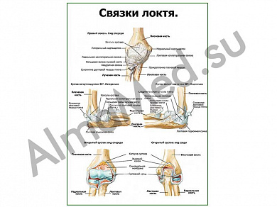 Связки локтя плакат глянцевый/ламинированный А1/А2 (глянцевый	A2)