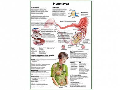 Менопауза плакат глянцевый А1/А2 (глянцевый A1)