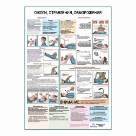 Ожоги, отравления, обморожения, плакат глянцевый А1+/А2+ (глянцевая фотобумага от 200 г/кв.м, размер A2+)