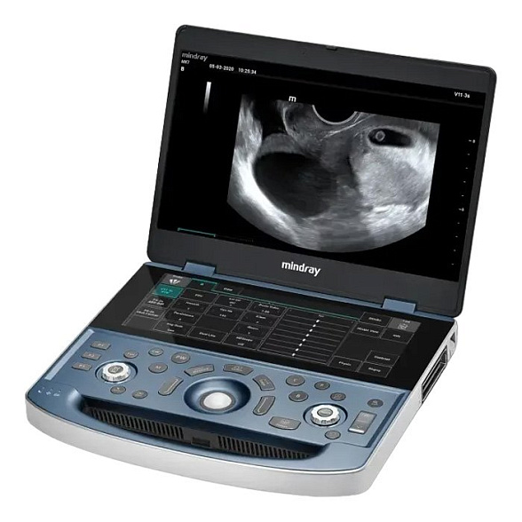 Ультразвуковой аппарат Mindray MX7