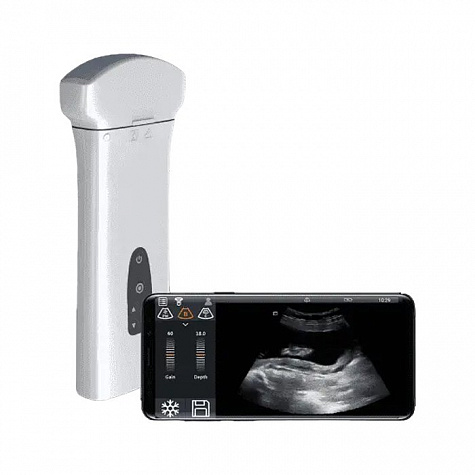 Беспроводная ультразвуковая система Delta 8 портативная