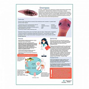 Описторхоз медицинский плакат А1+/A2+ (глянцевая фотобумага от 200 г/кв.м, размер A1+)