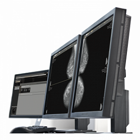 AI-платформа для анализа маммограмм ТриоДМ-МТ