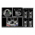 Fona XPan 3D - рентгенографическая цифровая система панорамной съемки