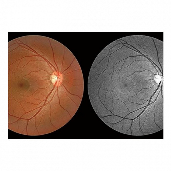 Томограф спектральный оптический когерентный, вариант исполнения: НОСТ-1, HUVITZ