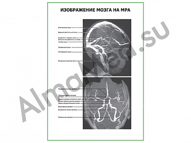 Изображение мозга на МРА плакат ламинированный А1/А2 (ламинированный	A2)