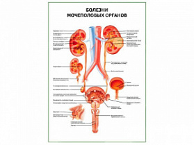 Болезни мочеполовых органов плакат глянцевый А1/А2 (глянцевый A2)