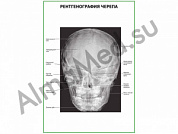 Рентгенография черепа плакат ламинированный А1/А2 (ламинированный	A2)
