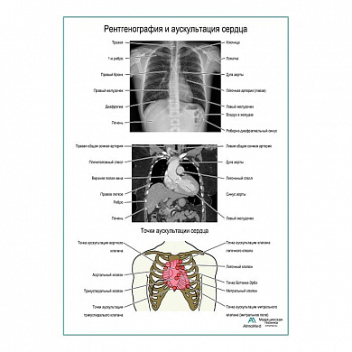 Рентгенография и аускультация сердца плакат глянцевый  А1+/А2+ (глянцевая фотобумага от 200 г/кв.м, размер A1+)