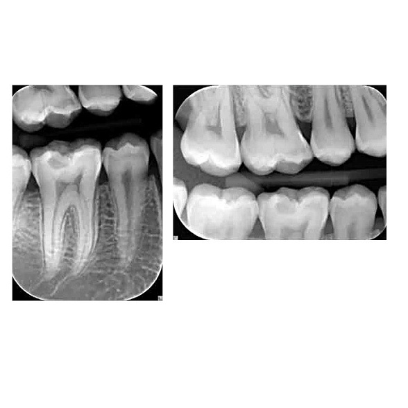 KaVo FOCUS - настенный дентальный рентгеновский аппарат | KaVo (Германия)