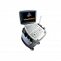 Ультразвуковой сканер S11 SonoScape