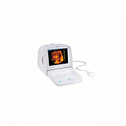 Портативный ультразвуковой сканер CTS 7700 Plus (COLOR) SIUI