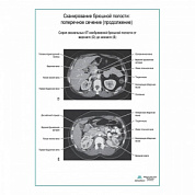 Сканирование брюшной полости: поперечное сечение (продолжение) плакат глянцевый А1+/А2+ (глянцевая фотобумага от 200 г/кв.м, размер A2+)