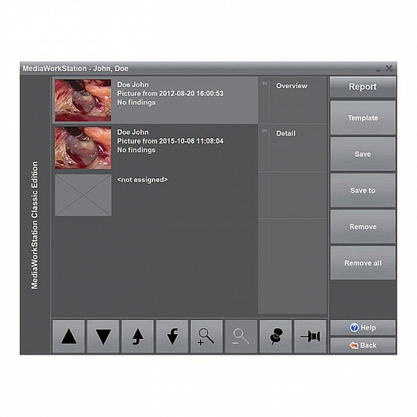 ПО для эндовидеокамер Dantschke MediaWorkStation 2.8 Classic