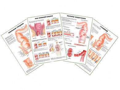 Комплект плакатов для кабинета проктолога глянцевый А1/А2 (глянцевый A1)