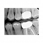 Carestream Dental RVG 6200 - радиовизиограф, 24 пар линий/мм