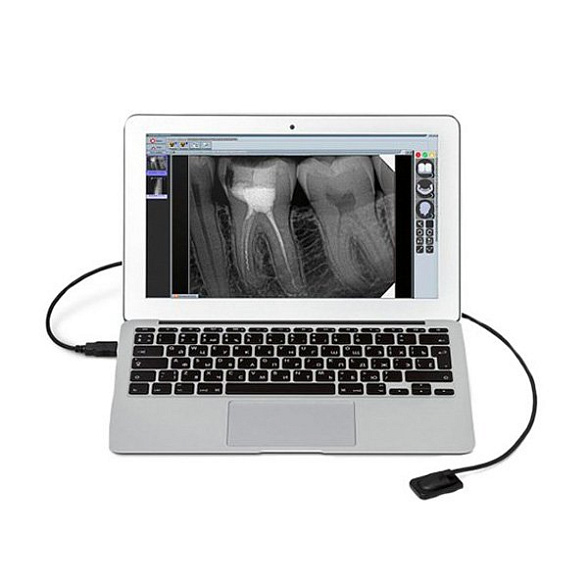 Радиовизиограф Mercury Digisens