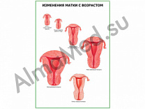 Возрастные изменения матки плакат глянцевый/ламинированный А1/А2 (глянцевый	A2)