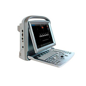 УЗИ сканер SonoTouch 50 Chison