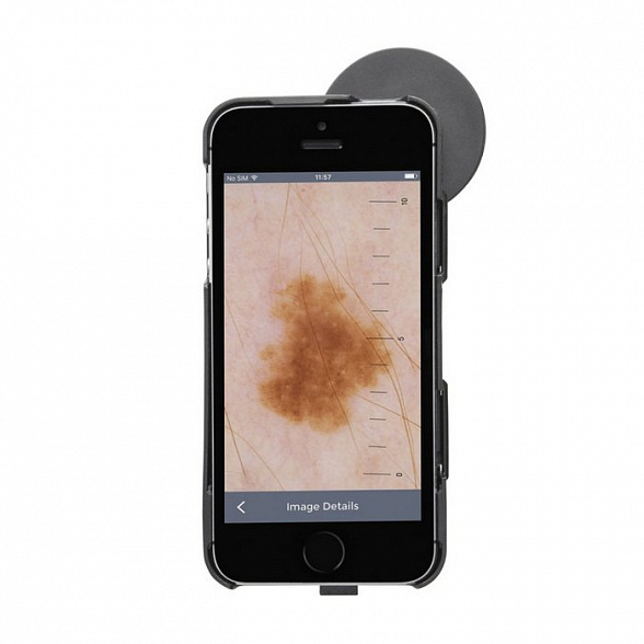 Дерматоскоп iC1 в наборе SET/12 Pro