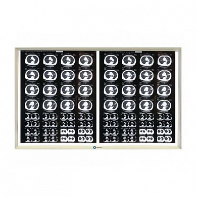Негатоскоп LED на 2 снимка