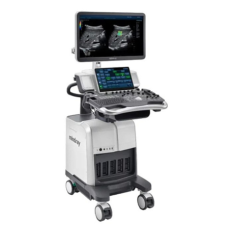 Ультразвуковой аппарат Mindray DC-80 X-Insight