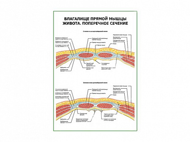 Влагалище прямой мыщцы живота. Поперечное сечение плакат глянцевый А1/А2 (глянцевый A1)
