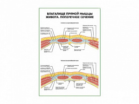 Влагалище прямой мыщцы живота. Поперечное сечение плакат глянцевый А1/А2 (глянцевый A2)