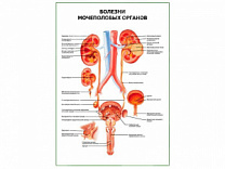 Болезни мочеполовых органов плакат глянцевый А1/А2 (глянцевый A1)