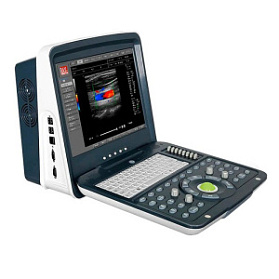 Портативный УЗИ сканер с цветным допплером AcuVista RS880i