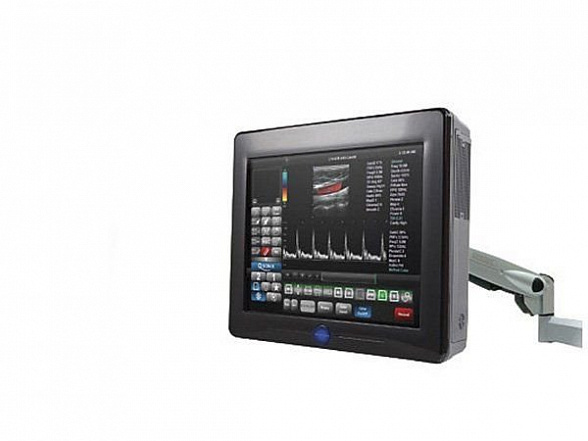 Sonix TABLET УЗИ сканер, Ultrasonix Канада