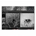 Томограф спектральный оптический когерентный, вариант исполнения: НОСТ-1, HUVITZ