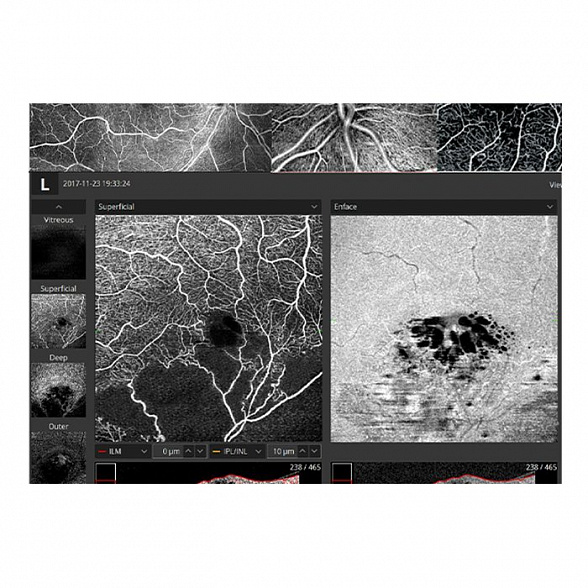 Томограф спектральный оптический когерентный, вариант исполнения: НОСТ-1, HUVITZ