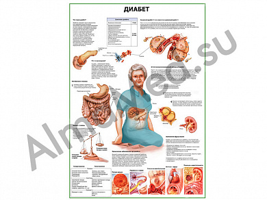 Диабет плакат глянцевый/ламинированный А1/А2 (глянцевый A2)