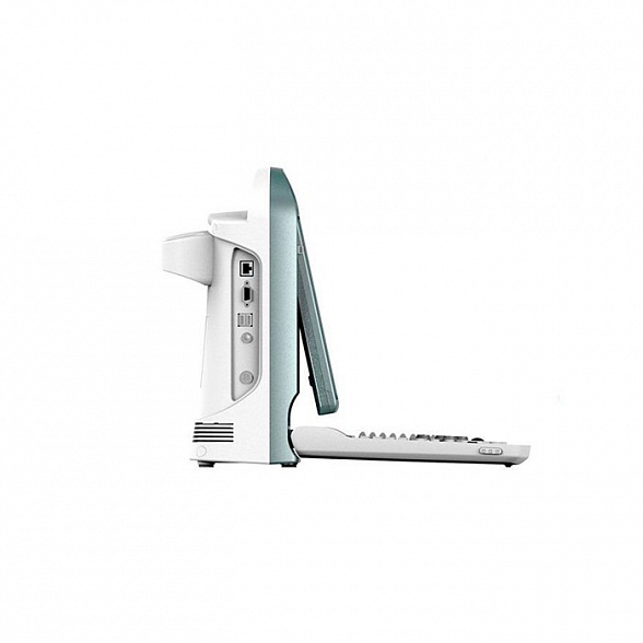 УЗИ сканер SonoTouch 50 Chison