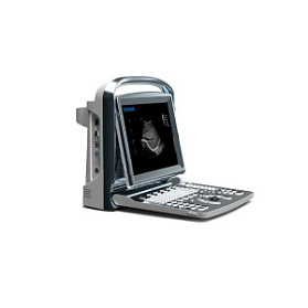 УЗИ сканер SonoTouch 10 Chison