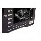 Портативный УЗИ сканер AcuVista RS880b