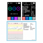 Портативный фетальный монитор Илифия