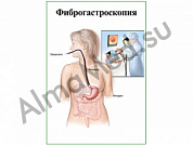 Фиброгастроскопия, плакат ламинированный А1/А2 (ламинированный	A2)