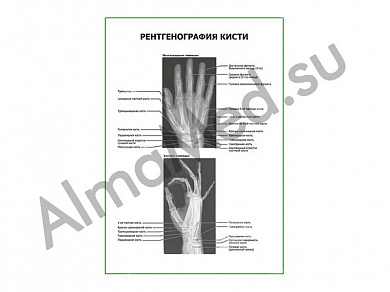 Рентгенография кисти плакат ламинированный А1/А2 (ламинированный	A2)