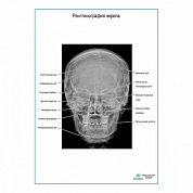 Рентгенография черепа плакат глянцевый А1+/А2+ (глянцевая фотобумага от 200 г/кв.м, размер A2+)
