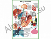 Вред алкоголя плакат глянцевый/ламинированный А1/А2 (глянцевый	A2)