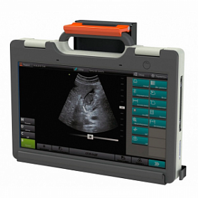 УЗИ сканер SmartScan 15 УЗИ сканер SmartScan 15