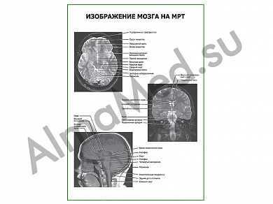 Изображение мозга на МРТ плакат ламинированный А1/А2 (ламинированный	A2)