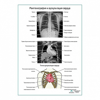 Рентгенография и аускультация сердца плакат глянцевый  А1+/А2+ (матовый холст от 200 г/кв.м, размер A1+)